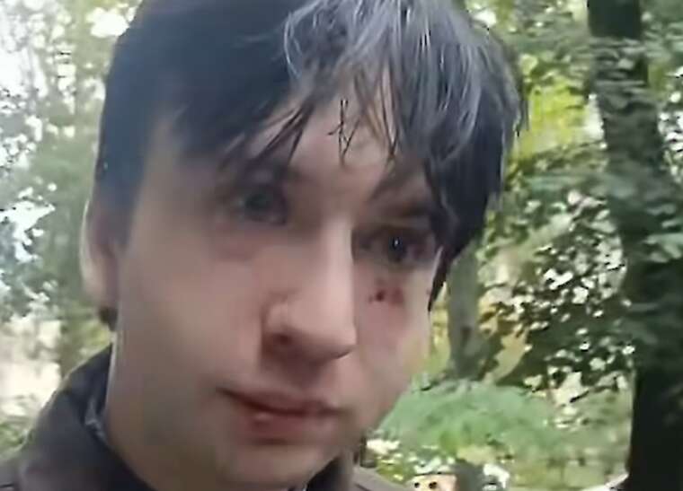 «Таким як ти тут не раді»: у Львові близько 20 чоловіків напали на ветерана ЗСУ та історика Владислава Стародубцева